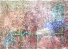 سرنگ بوتاکس و ابزار تزریق آماده روی سینی استریل کلینیک